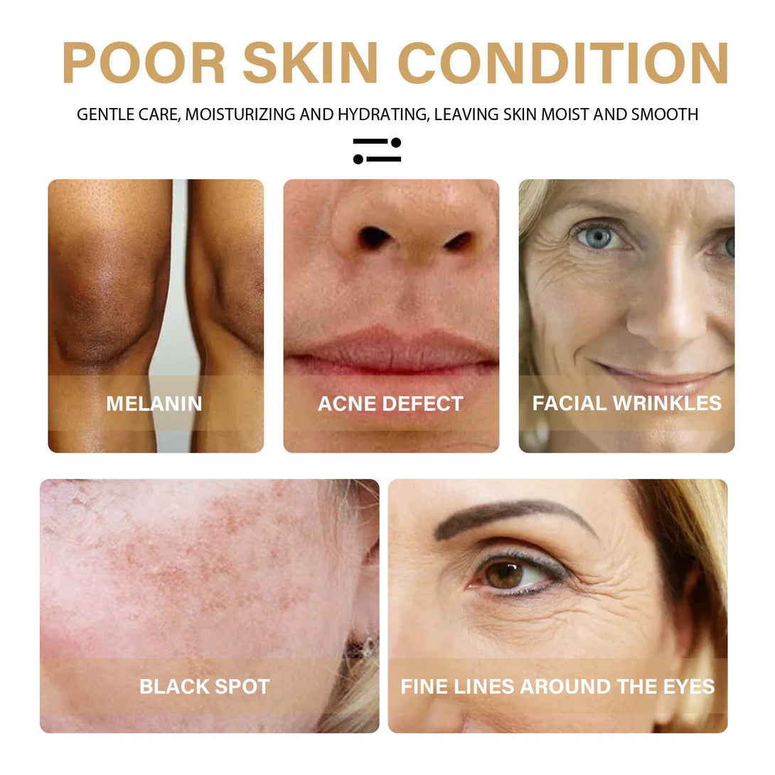 BLYNTRA Turmeric Serum – Fade Dark Spots, Reveal Radiance BLYNTRA