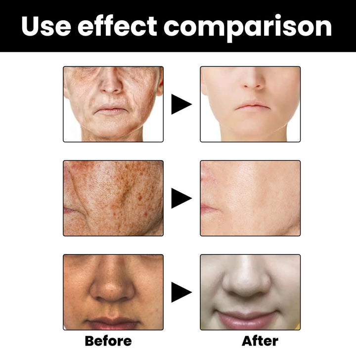 Facial Melanin Repair Hydrating Skincare Products BLYNTRA