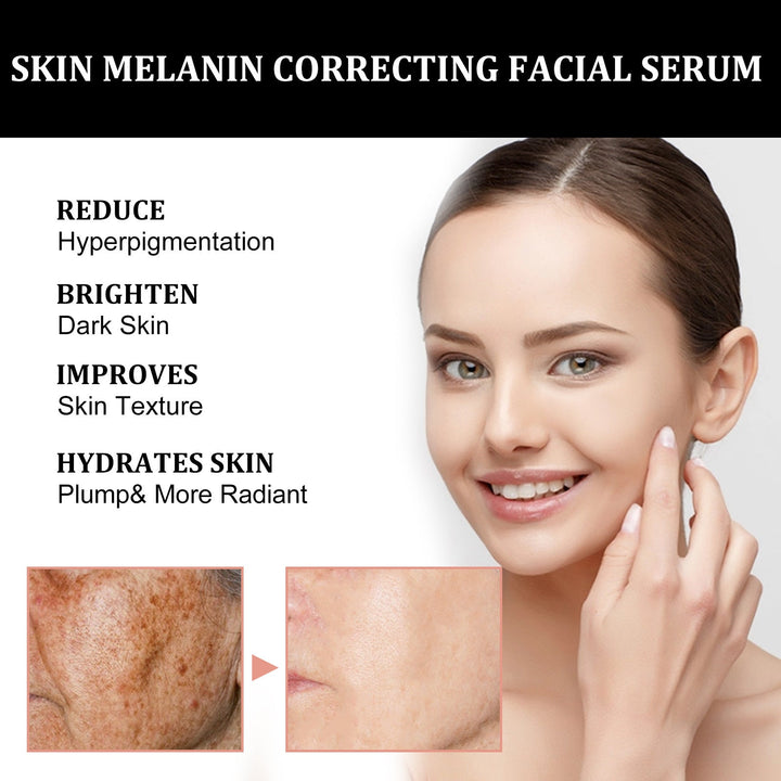 Facial Melanin Repair Hydrating Skincare Products BLYNTRA