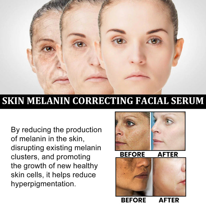 Facial Melanin Repair Hydrating Skincare Products BLYNTRA