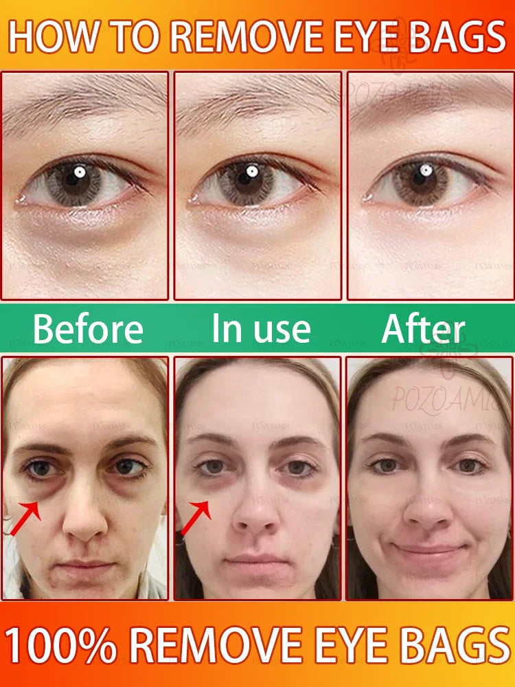 Stay Up Late Eye Essence BLYNTRA