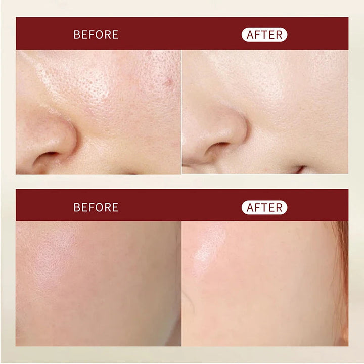 Glow Rice Ampoule Rice Essence Moisturizing And Hydrating Gentle Cleansing Peel Shot Exfoliant Repair Skin Niacinamide Essences BLYNTRA