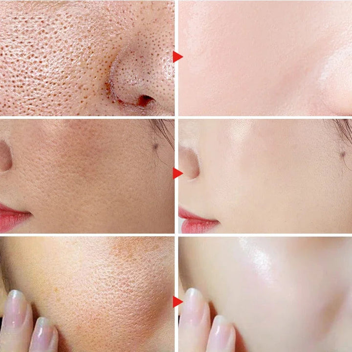 CHUMOLEE Ectoine Face Cream Moisturizing Refreshing Texture Friming Skin Care Skin Streaming Facial Essence Cream SHOPPING HUB