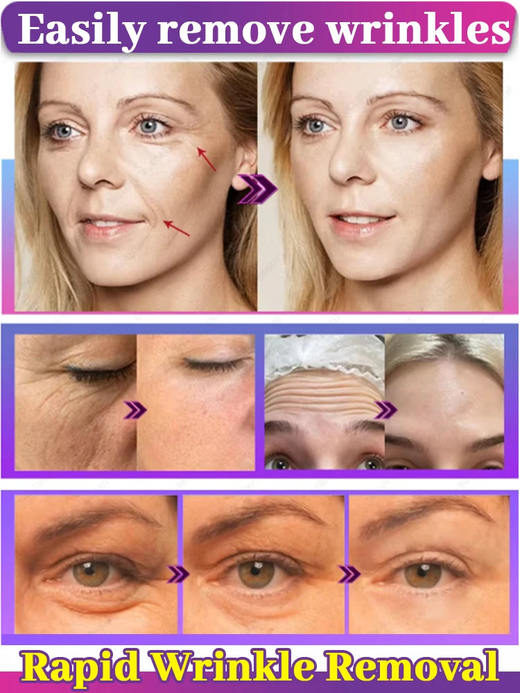 100% Younger Eye Essence BLYNTRA