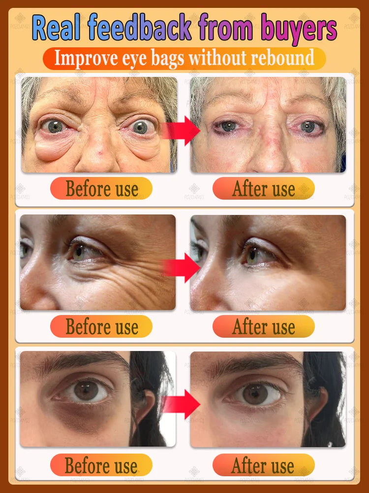 Stay Up Late Eye Essence BLYNTRA