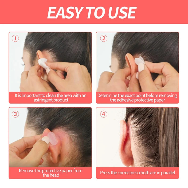 BLYNTRA Ear Fixer Patches – Invisible, Non-Surgical Correction BLYNTRA