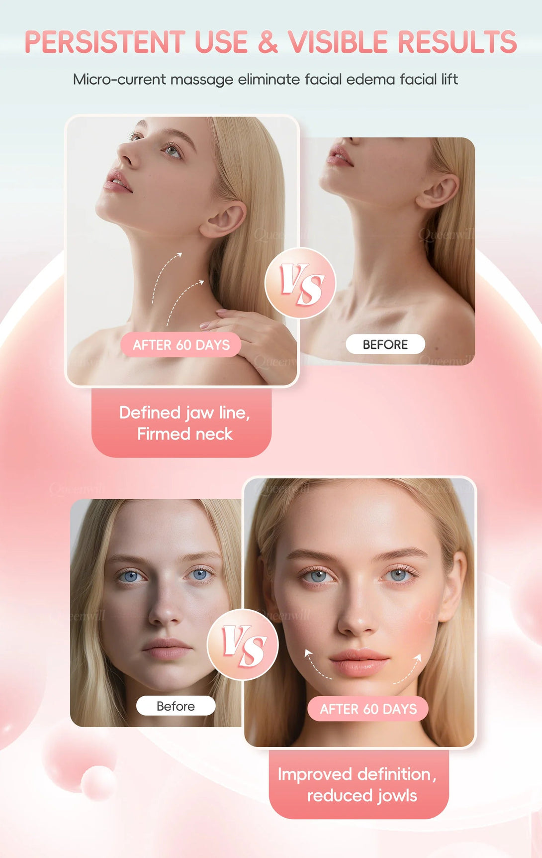 EMS Microcurrent Facial Lifting Massager BLYNTRA