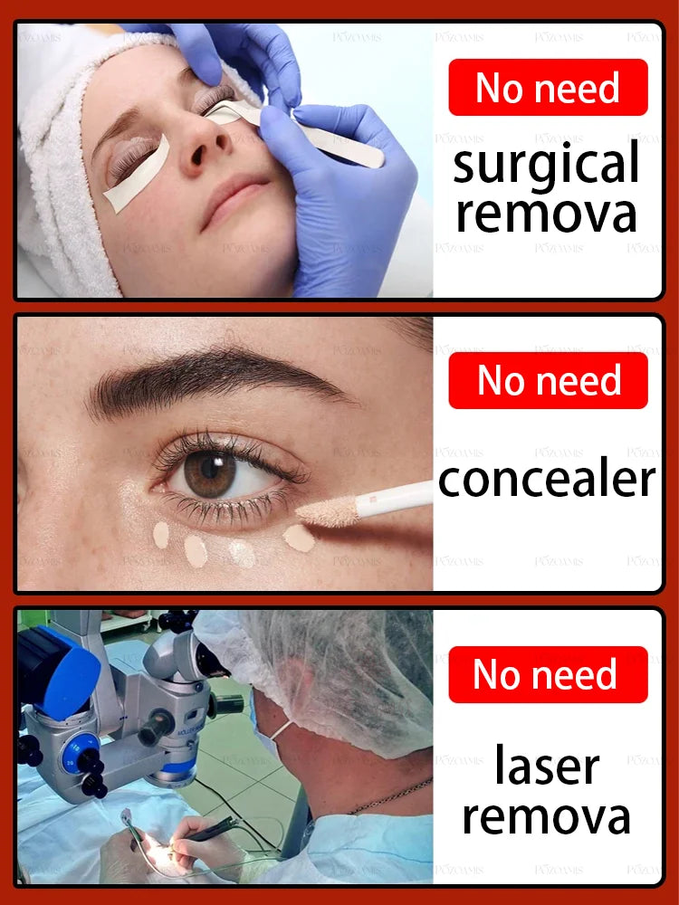 Stay Up Late Eye Essence BLYNTRA