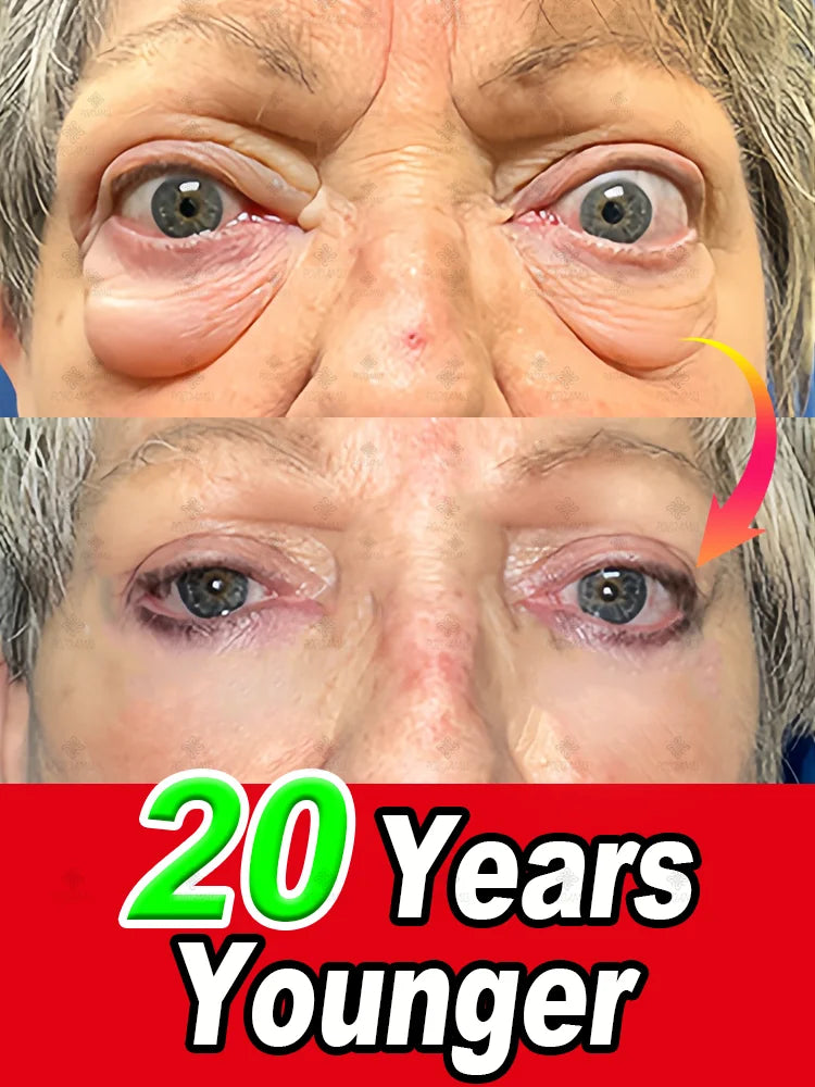 Stay Up Late Eye Essence BLYNTRA