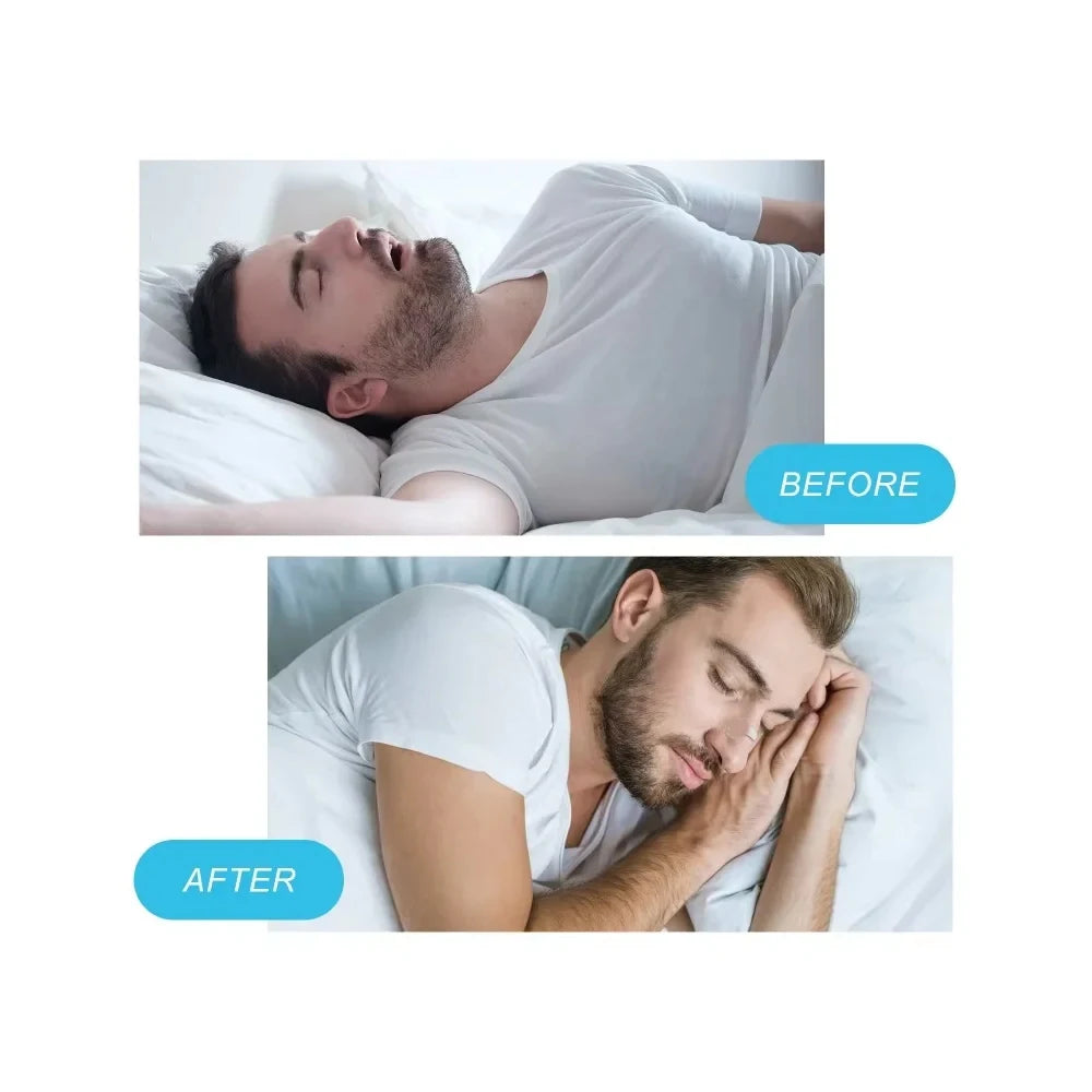 C6 Nasal Breathing Starter Kit BLYNTRA