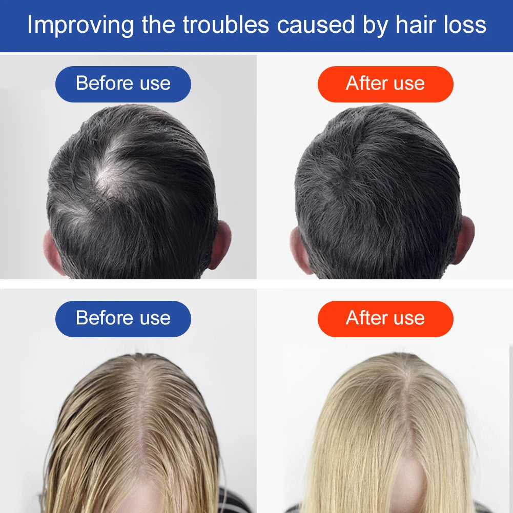 TheraGlow Red Light Hair & Scalp Therapy Helmet SHOPPING HUB